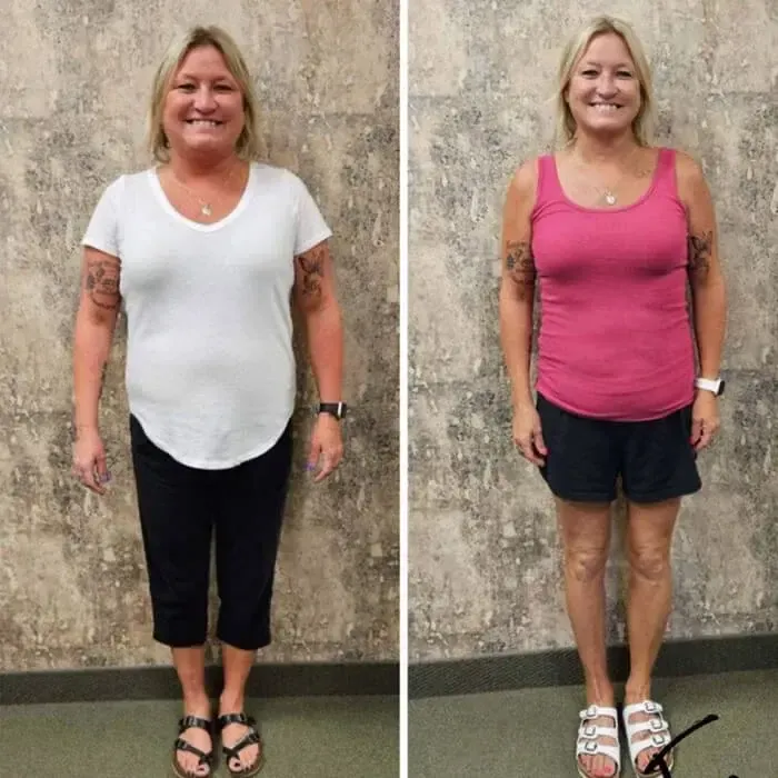 Cathy J. before and after