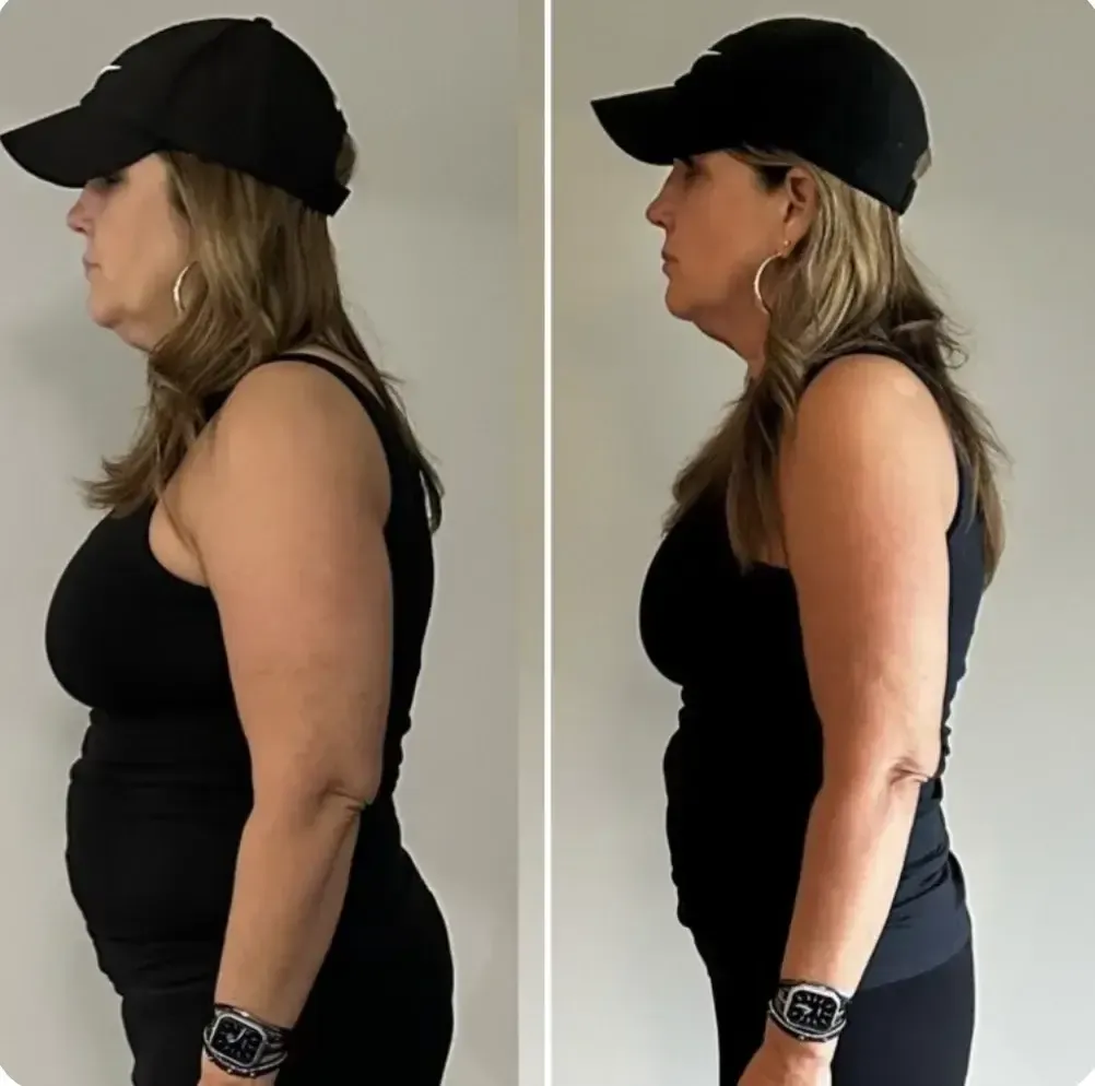 Michelle before and after — Lost over 40 lbs